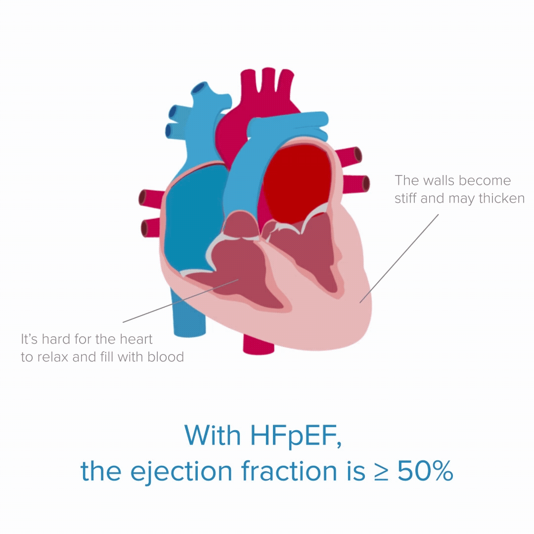 A diagram of a human heart

Description automatically generated